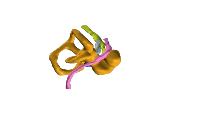 Read more about the article 3D reconstruction of cochlea