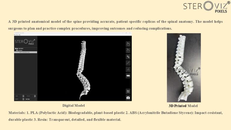Read more about the article Anatomical Model for spine