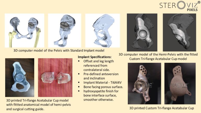 Read more about the article Custom Triflange