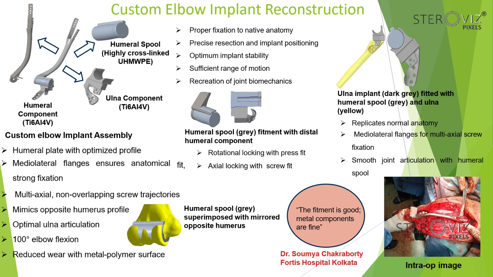 Custom Elbow Implant