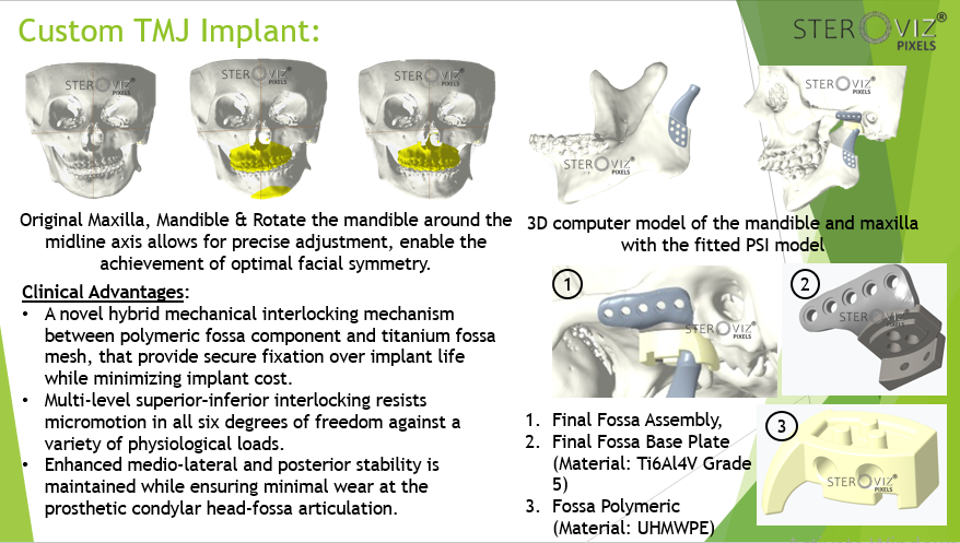 Custom TMJ implant
