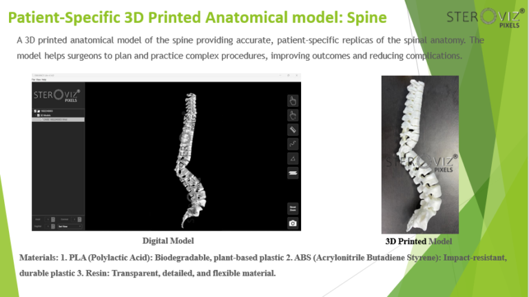 Read more about the article Anatomical Model for spine