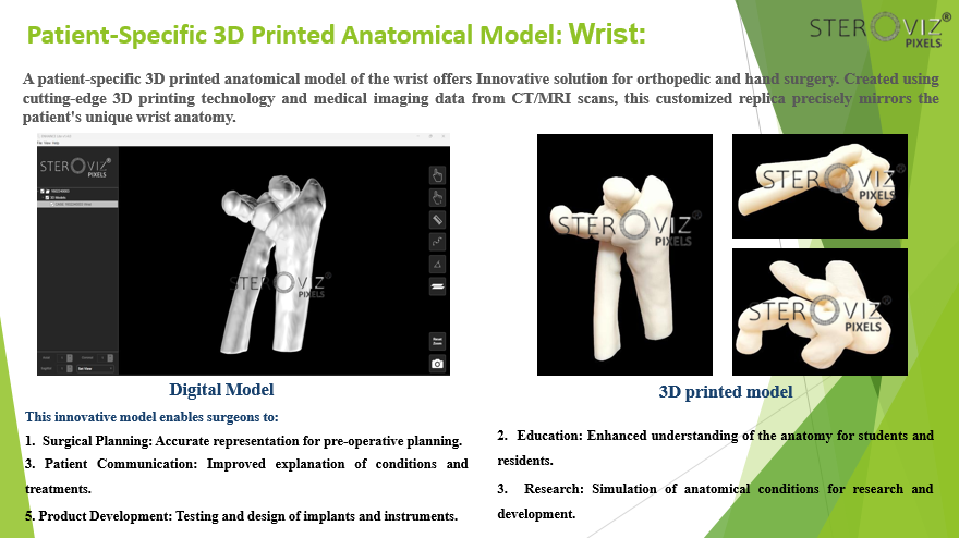 Anatomical Model for Wrist Fracture
