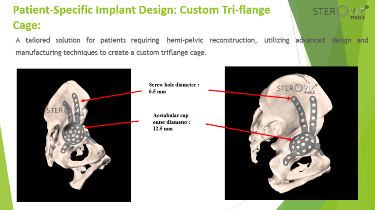 Read more about the article Custom Triflange