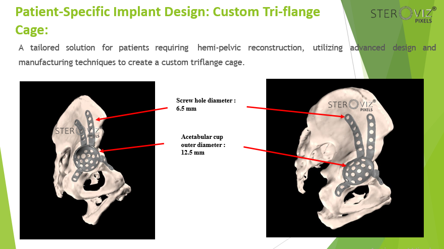 Custom Triflange