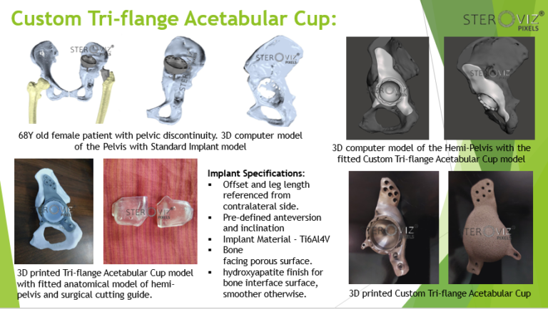 Read more about the article Custom Triflange Cup