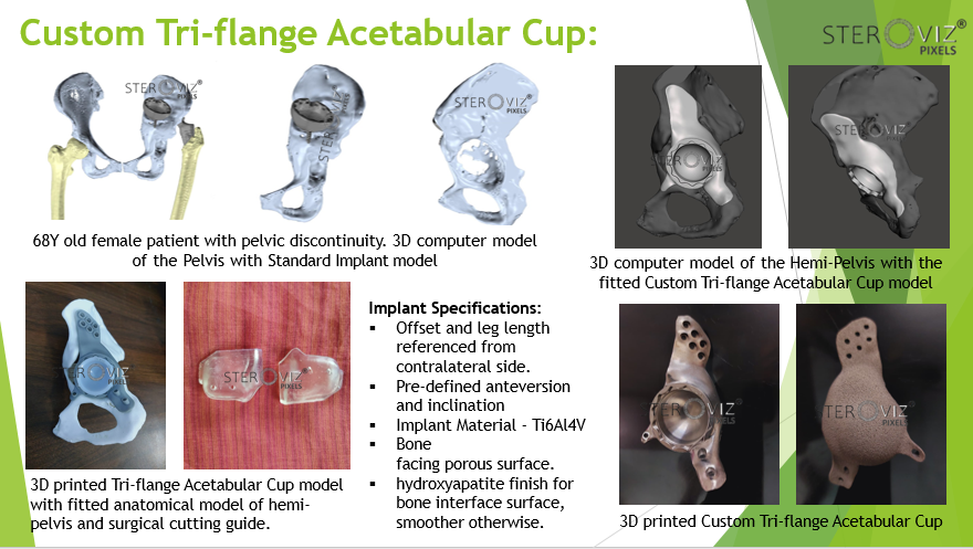Custom Triflange Cup