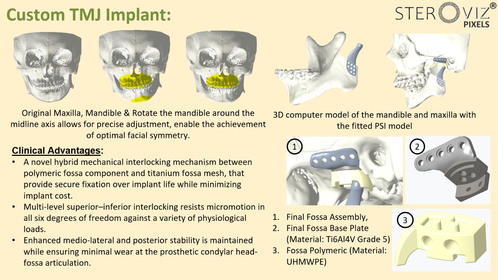 Custom TMJ implant