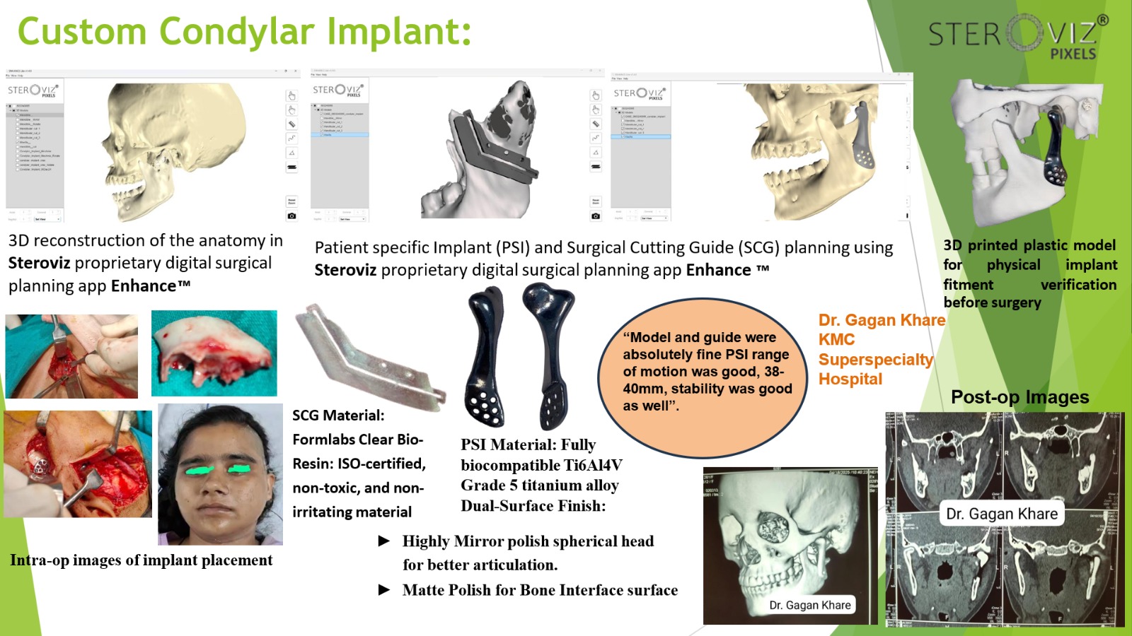 Custom Condylar Implant