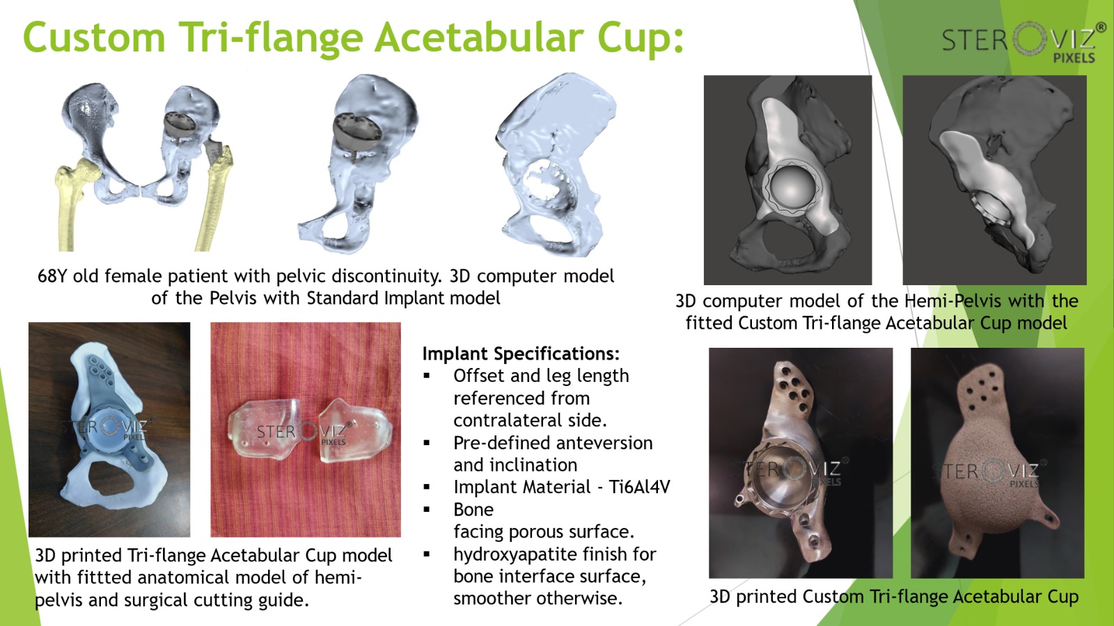 Custom Triflange