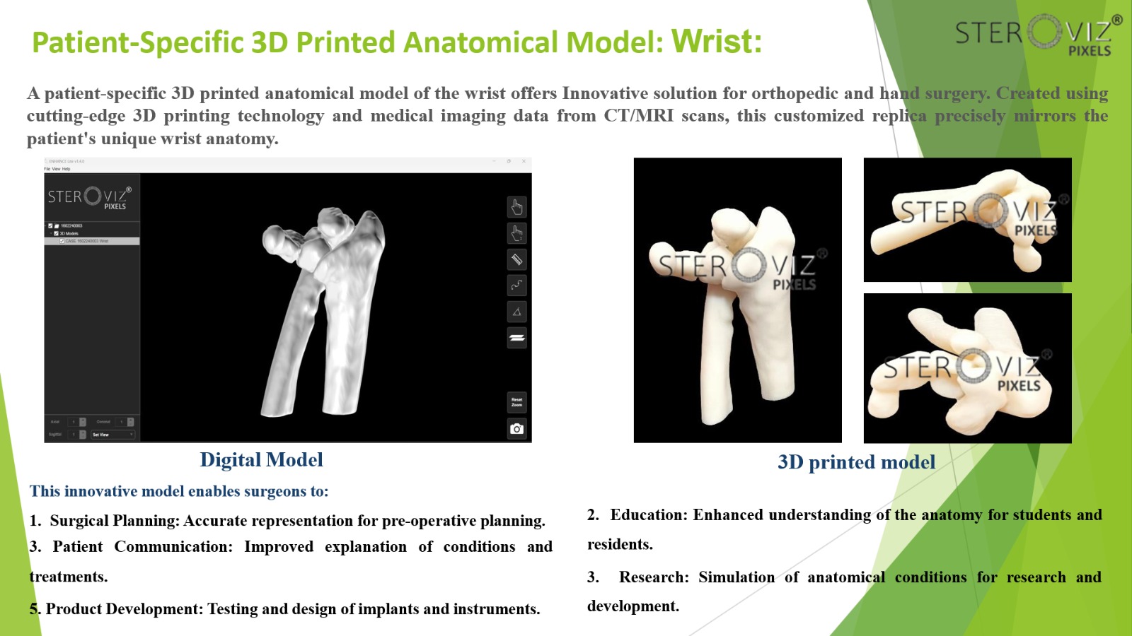 Anatomical Model for Wrist Fracture
