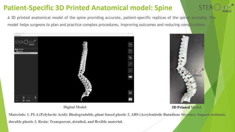 Read more about the article Anatomical Model for spine
