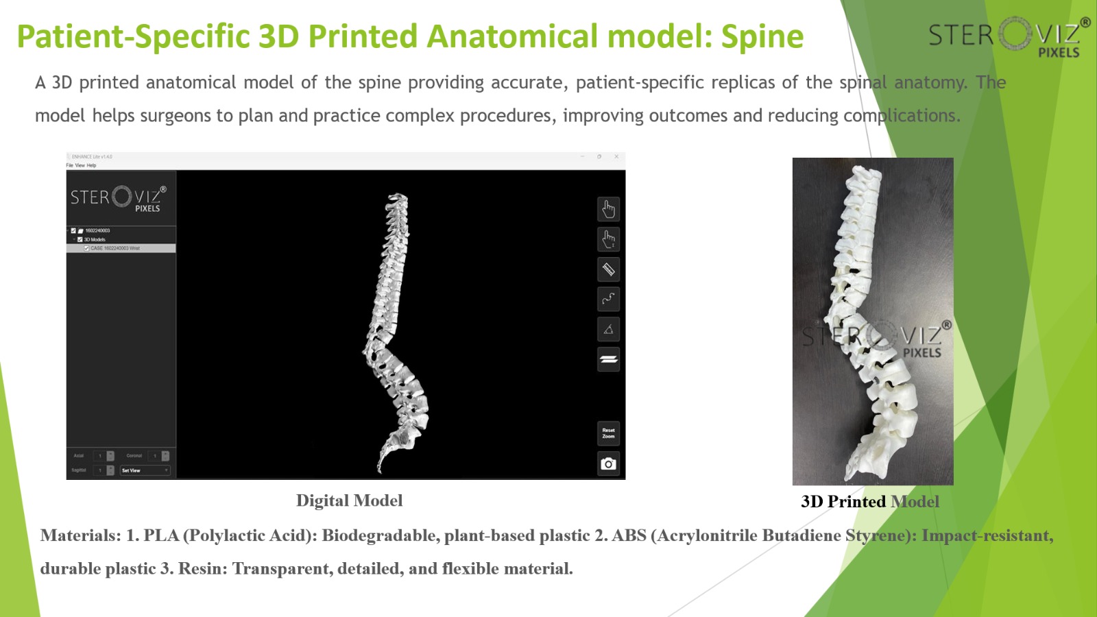 Anatomical Model for spine