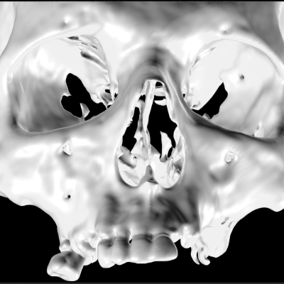 3D reconstruction of the maxilla