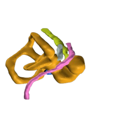 3D reconstruction of cochlea